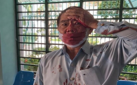 Phó trưởng phòng bị hành hung sau cuộc họp cuối năm: nguyên nhân từ đâu
